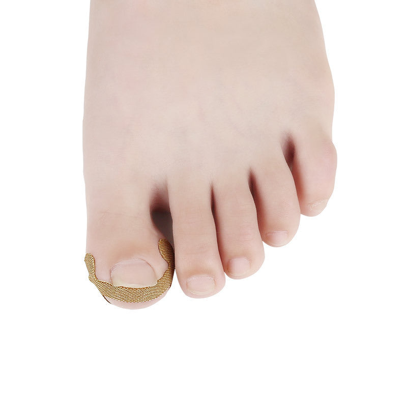 Ingrown Toenail Correction Patches – Pain-Free Nail Recovery Solution