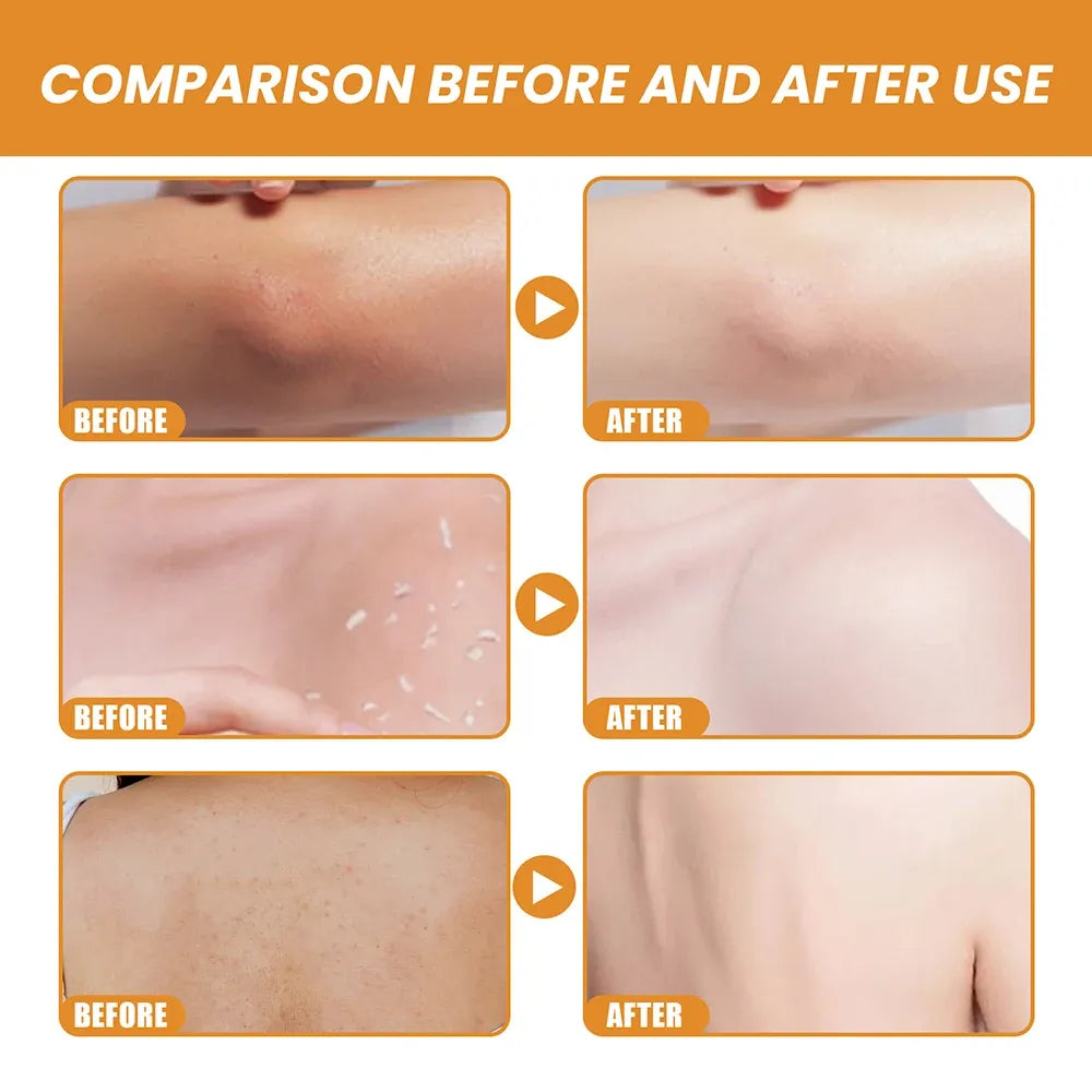 Before after comparison showing smoother brighter skin from exfoliating gel