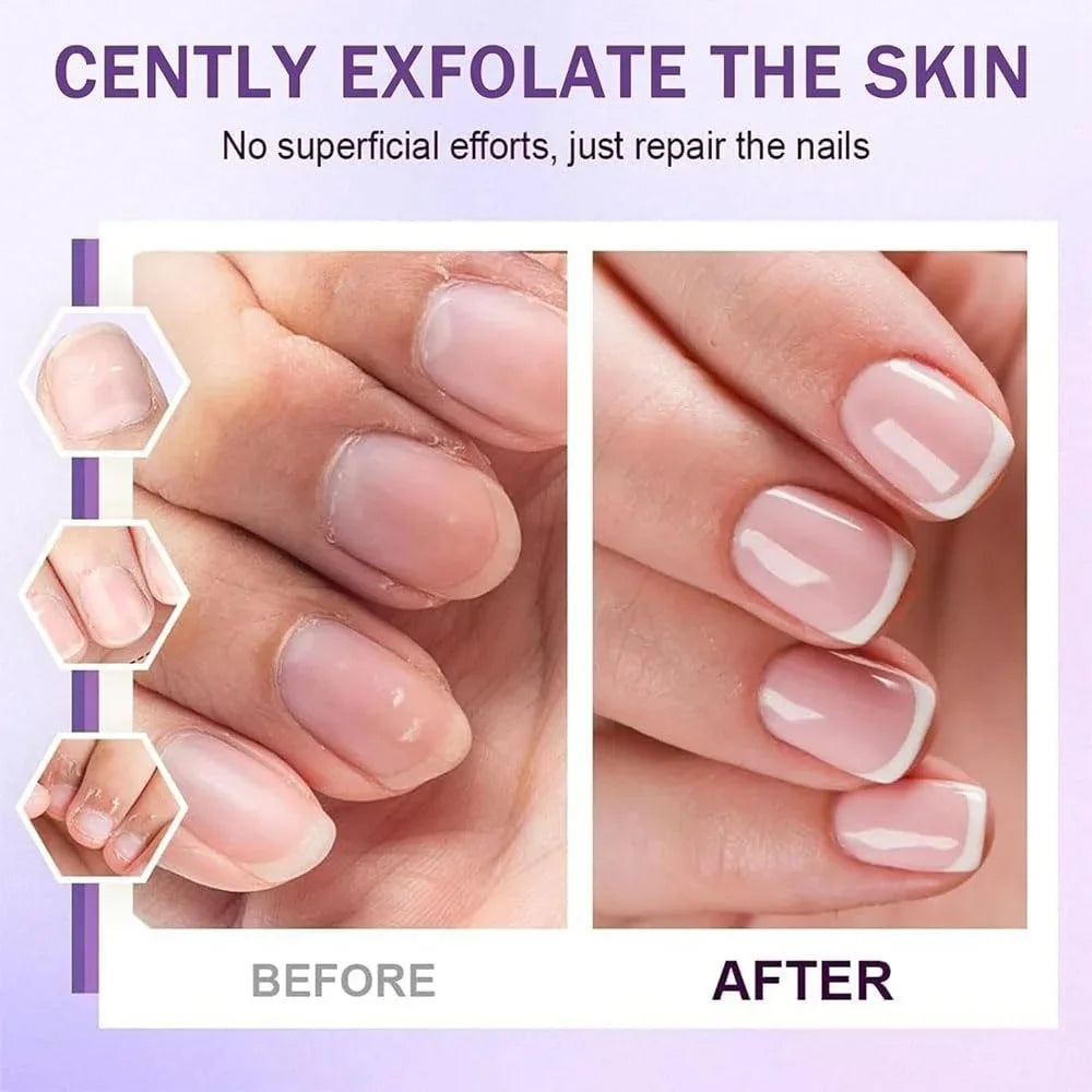 Before and after nails using cuticle remover pen showing healthier cuticles