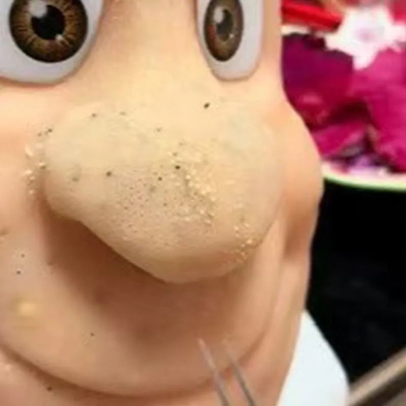 Pimple popping toy